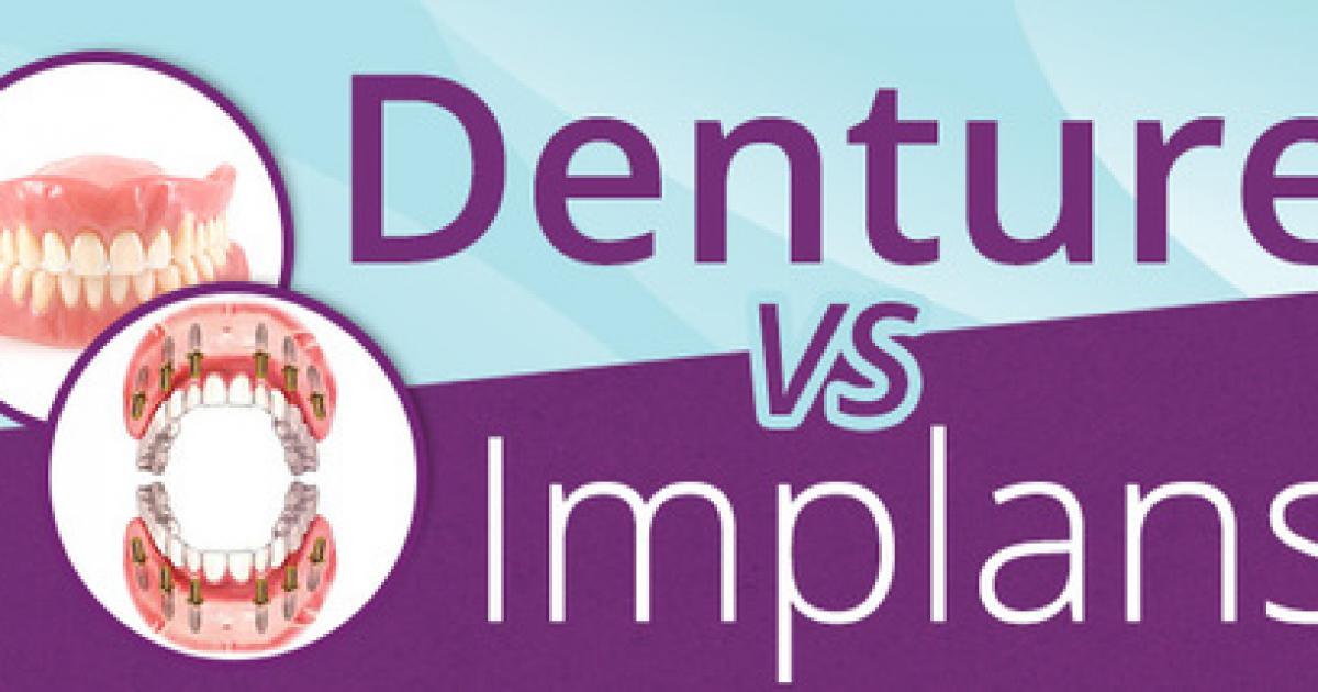 Dentures or Implants, Los Algodones, Mexico, Advantages, Disadvantages